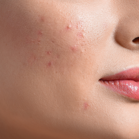 Pelle Con Imperfezioni e Discromie