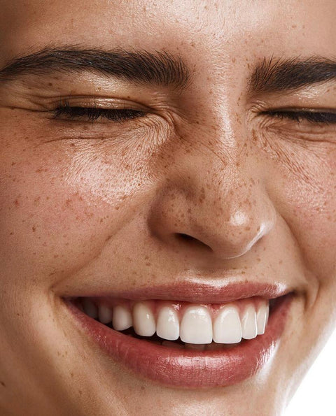 Pelle con imperfezioni e discromie